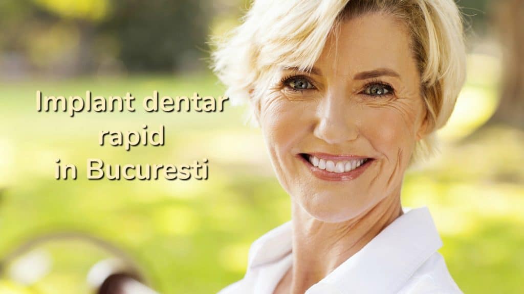 Implant dentar rapid